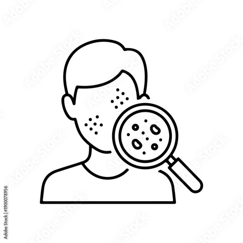 Medical concept vector illustration showcasing a person's facial skin under magnification, detailing dermatological issues such as acne, pimples, and blemishes for healthcare