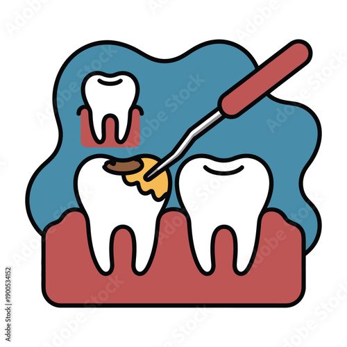 A cartoon illustration of a dentist's tool cleaning a tooth with a yellow plaque buildup.