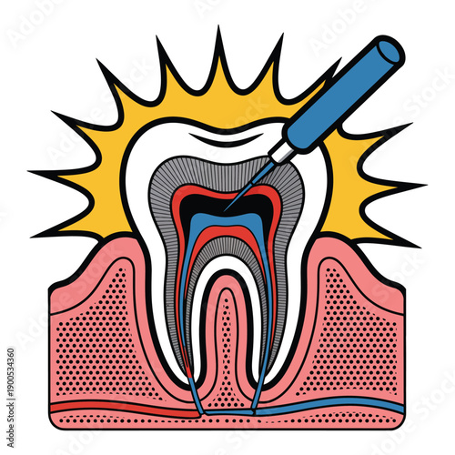 A cartoon illustration of a tooth being injected with anesthesia by a dentist's syringe