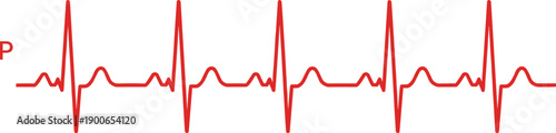 Red electrocardiogram waveform showing P wave, QRS complex, T wave, heart rhythm medical illustration for cardiology, diagnostics, patient monitoring healthcare