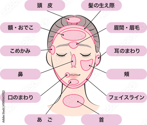 ニキビができやすい場所マップ
