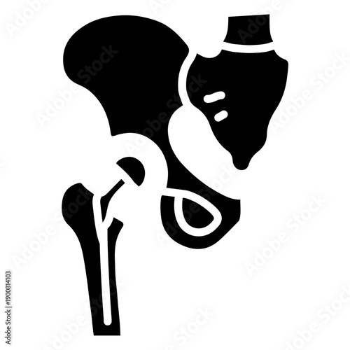 Hysterectomy Vector Icon