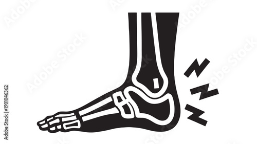 Ankle sprain injury icon with foot skeleton and pain zigzag marks, black and white medical pictogram for healthcare, orthopedics, trauma, and first aid