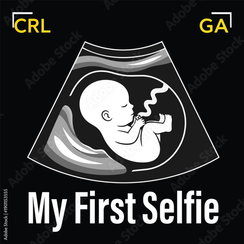 Medical ultrasound baby scan vector icon