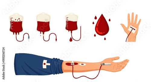 Blood Donation Process with IV and Bags.