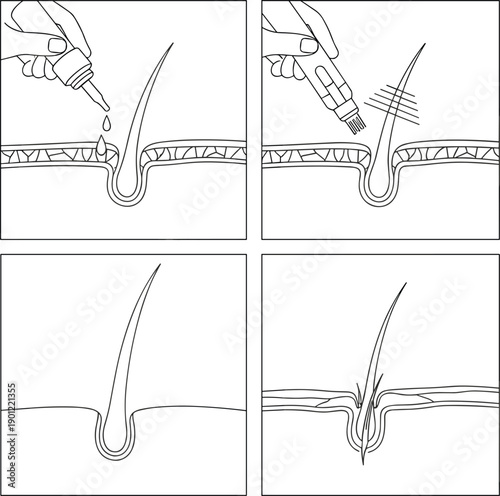 Hair removal and skin follicle treatment icons representing dermatology beauty cosmetic procedure skincare medical vector illustration outline design
