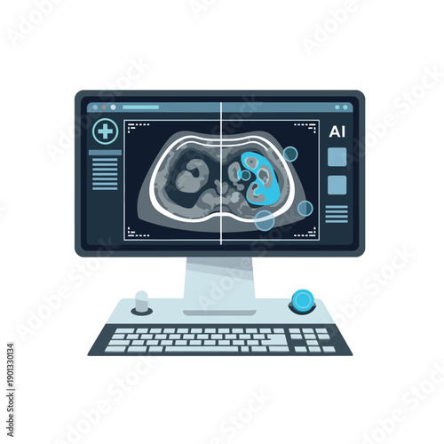 Computer monitor displaying medical imaging software with AI analysis of human lungs.
