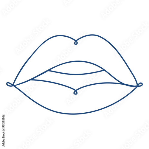 Lip fillers continuous line