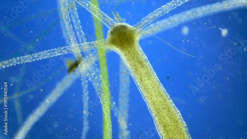 Hydra under the microscope at 40x Magnification