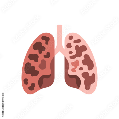 An illustration of lungs with damaged areas representing a respiratory health issue