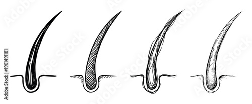Hand-drawn hair follicle and strand illustrations in a set of four different black and white sketch styles, a detailed anatomical drawing for scientific or cosmetic study