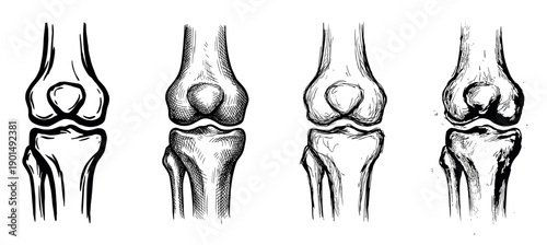 Four hand-drawn sketch illustrations of a human knee joint showing the femur and tibia bones in a detailed anatomical study set with various ink drawing styles for medical education