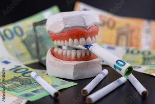 Obraz na płótnie Dental jaw model biting euro banknote with cigarettes and cash on black background for expensive dentistry healthcare costs and smoking addiction health impact concept