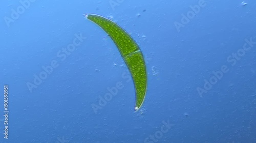 Paramecium and green algae under the microscope at 100x Magnification