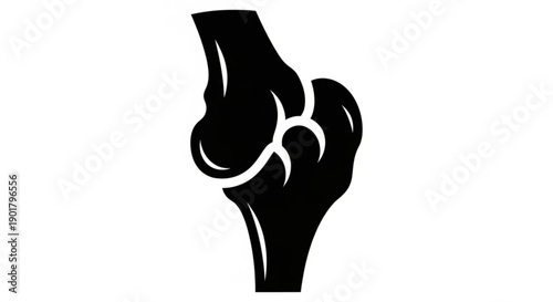 Detailed illustration of a human knee joint from a lateral viewpoint showcasing anatomical structure