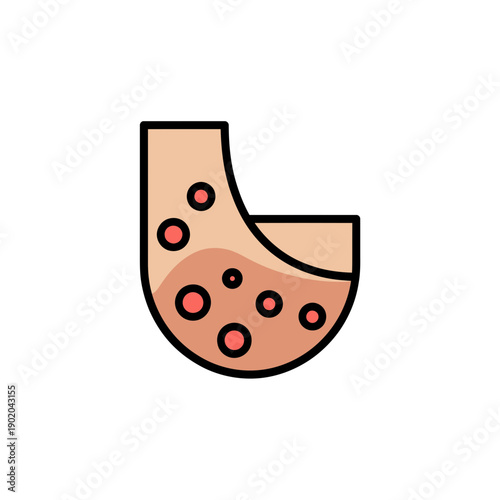An illustration of a human elbow with red spots and black outlines