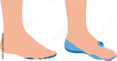 Stylish foot illustrations with blue accents on toes