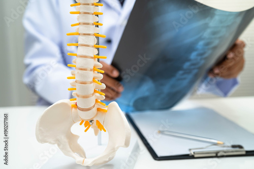 Bild auf Leinwand Doctor examining spine bone radiography xray film.