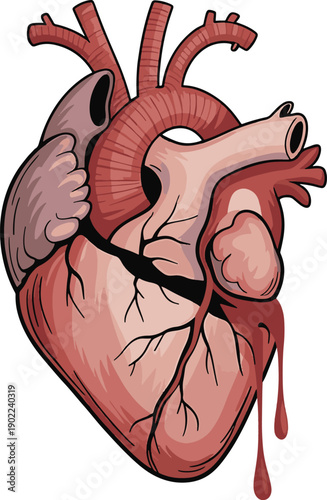 Cracked Anatomical Heart with bloody drop