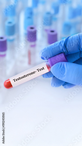 Testosterone blood test tube held by gloved hand for hormone level analysis in medical laboratory.