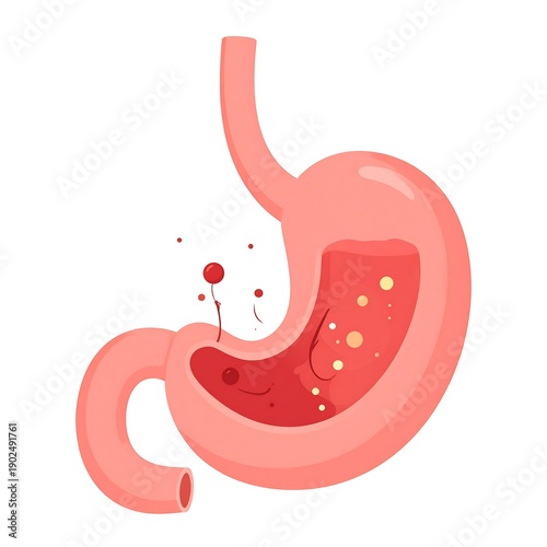 Human stomach illustration, pink exterior, section view with red content & floating particles