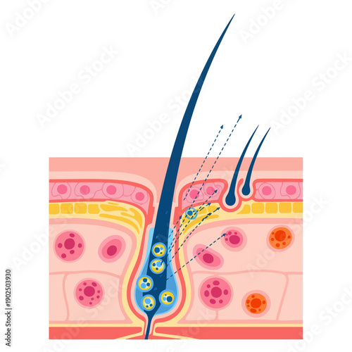 Human Hair Follicle Anatomy Diagram
