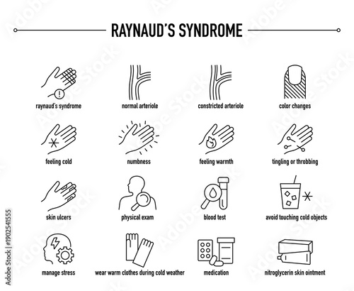 Raynaud's Syndrome symptoms, diagnostic and treatment vector icon set.