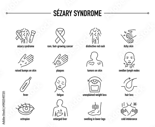 Sézary Syndrome symptoms, diagnostic and treatment vector icon set