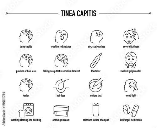 Tinea Capitis symptoms, diagnostic and treatment vector icon set