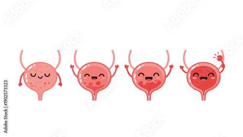 Medical illustration showing stages of bladder health and infection represented by cute anthropomorphic characters.