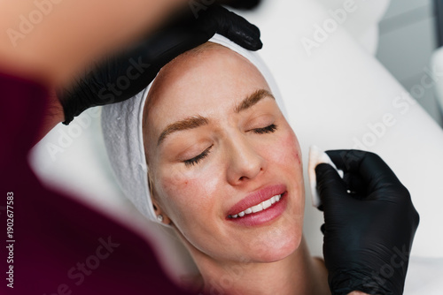 Tableau sur toile A professional cosmetologist in black gloves cleans a woman's face during a skin care procedure