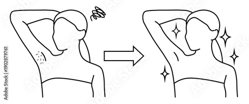 女性の脇脱毛ビフォーアフターの線画イラスト