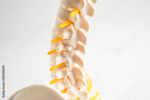 Photos Lumbar spine displaced herniated disc fragment, spinal nerve and bone