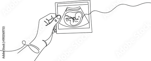 Continuous line drawing of hand holding ultrasound baby photo for prenatal diagnostics sonography and pregnancy announcement concept