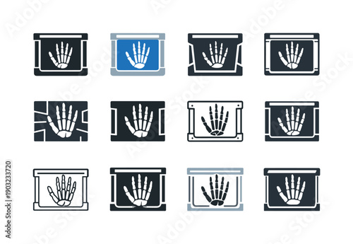 X-ray film on lightbox. Icon set. Set Logo of x-ray film on lightbox: hand bones on screen. harmonious logo variations of the same emblematic