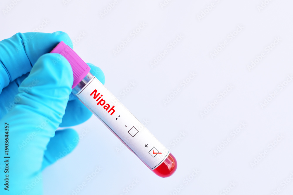 Obraz premium Blood sample tube positive with Nipah virus test