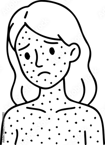 Female Character with Skin Rash Icon - Dermatology Allergy or Freckles Portrait Line Art Vector - Medical Healthcare and Skincare Symbol