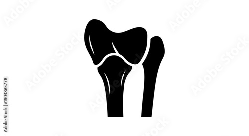 Black silhouette of a human knee joint with highlighted bone structure.