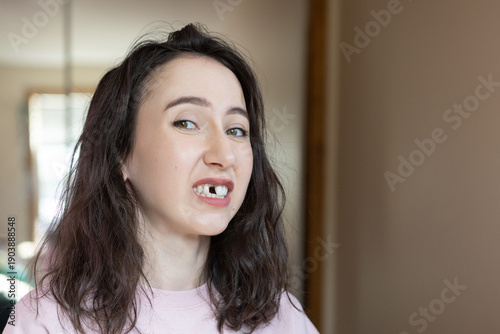 Bild auf Leinwand Mature Caucasian brunette woman missing a front tooth.