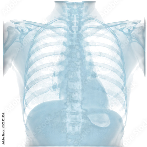 Medical X-ray Showing Human Chest Anatomy and Bones From the Back View in a C...