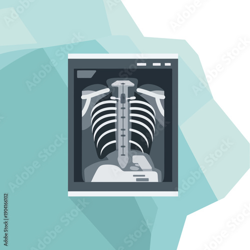 X-ray of human spine and rib cage on screen, medical illustration