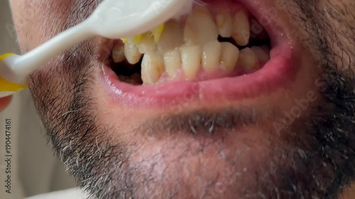 Man brushing unhealthy teeth and gums with toothbrush and toothpaste. Smiling beared guy enjoying morning oral anticavity hygienic routine alone in bathroom. Brush your teeth for your health.