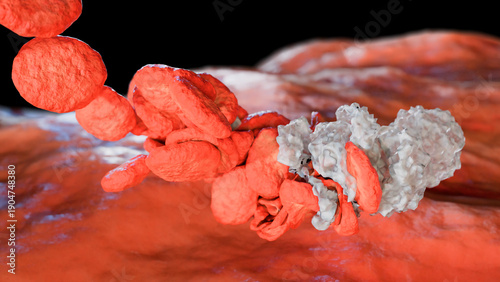 Photos Formation of a blood clot, blocked blood, Clot in blood vessels, arteries and ca