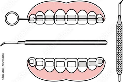 Orthodontics Dental Care Illustration. Dental Braces Treatment Illustration. Orthodontic Teeth Alignment Illustration. Modern Orthodontics Dental Illustration. Dental Clinic Orthodontics Illustration