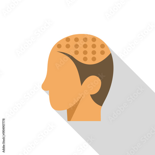 Human head profile representing a hair loss restoration procedure with implanted follicles