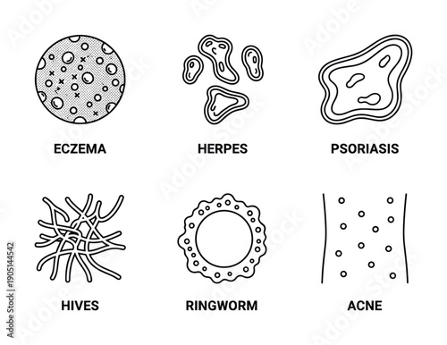 Eczema, Herpes, Psoriasis, Hives, Ringworm, and Acne Skin Diseases Line Art