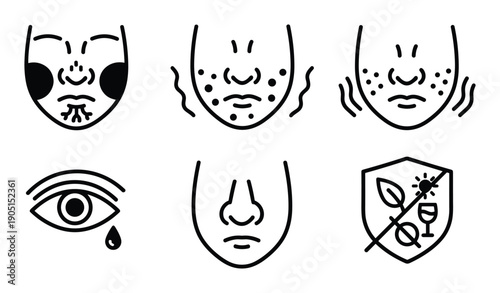 Rosacea symptoms and causes line art vector illustration and dermatology skin problem concept