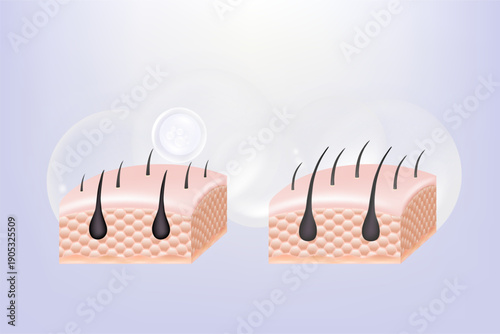 Hyaluronic acid and Niacinamide before and after hair and skin solutions ad. white collagen serum drop into skin cells with cosmetic advertising background ready to use, illustration vector.