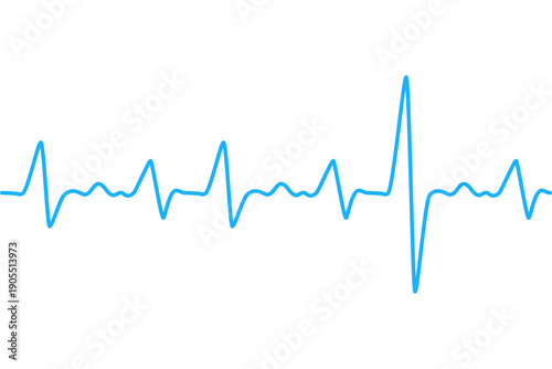 A blue electrocardiogram line graph on a plain background illustrates a heartbeat pattern in a medical context from a direct viewpoint