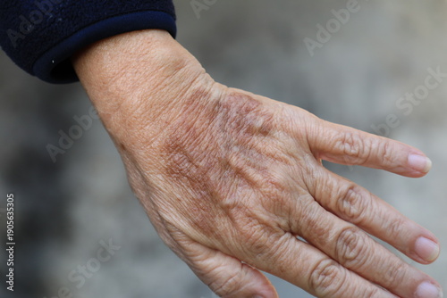 ging hands aging hands aging hands showing wrinkles and age spots, elderly hands, senior skin texture, aging process, healthcare and aging society concept